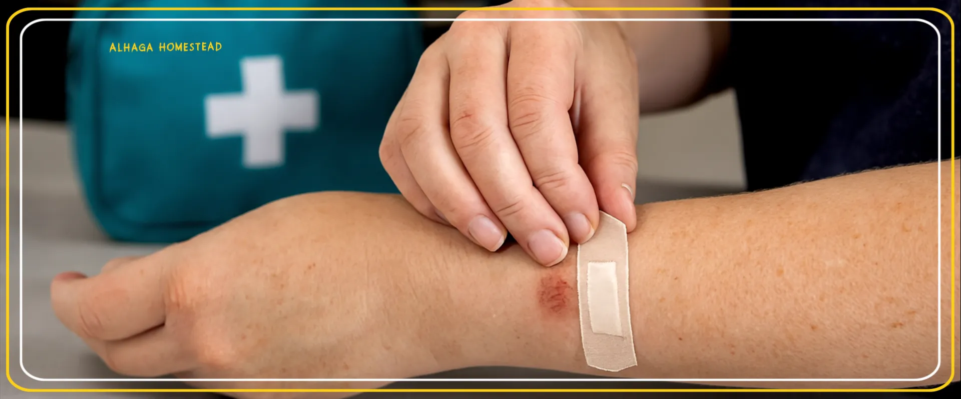 Cuts ‘n skin woes - Alhaga homestead